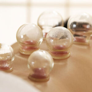 Cupping – $40