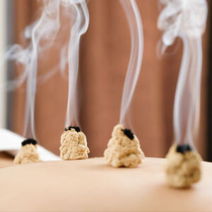 Moxibustion – $40